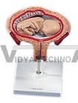 5th Month Fetus, breech position Pregnancy Model